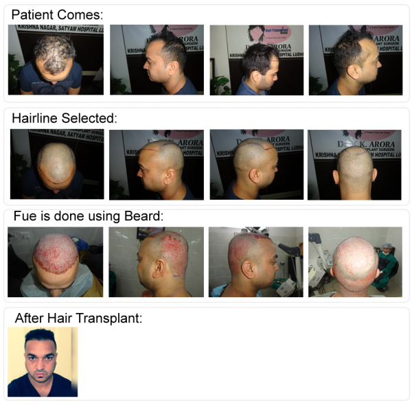 Satyam Hair Transplant Centre (Ludhiana, India) - Contact Phone, Address