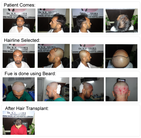 First Choice Hair Transplant  Cosmetics in DugriLudhiana  Best Skin Care  Clinics in Ludhiana  Justdial